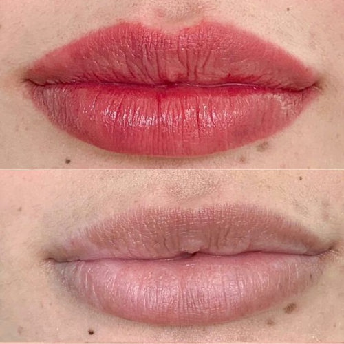 Ergebnis Lippen