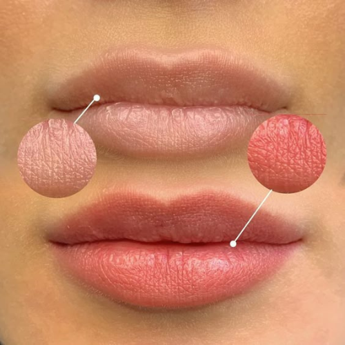 Ergebnis Lippen