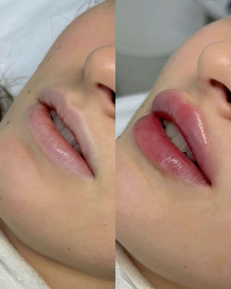 Ergebnis Lippen