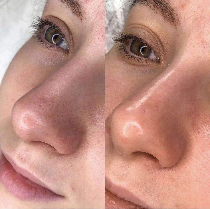 Gepflegtes Hautbild nach einer Gesichtsbehandlung bei Roxana Beauty Bar