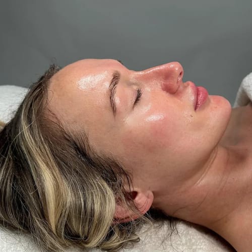 Reines Hautbild nach einer Gesichtsbehandlung bei Roxana Beauty Bar